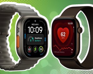 Apple-Watch-12-Nutzer kämpfen mit schmerzhaftem Problem: „Ist das nur bei mir so?“