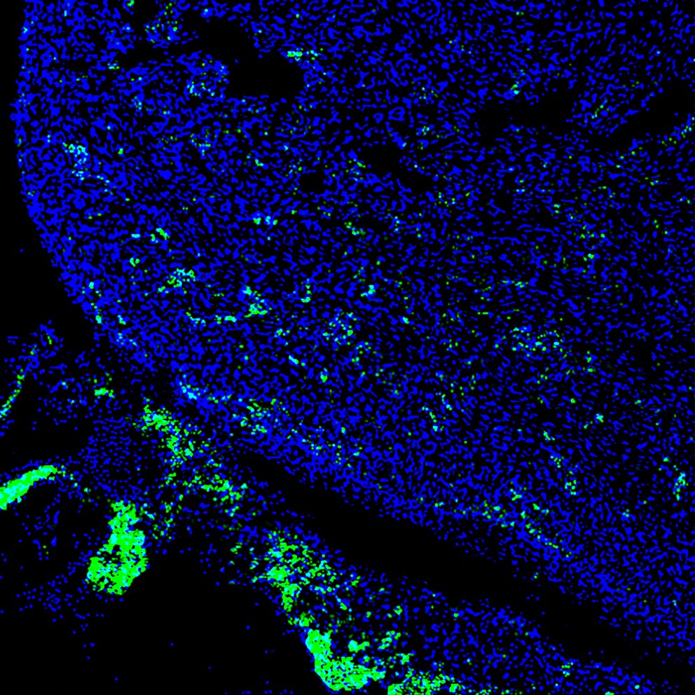Menschliche Stammzellen (grün) in einem sich entwickelten Herzen eines vier Wochen alten Schweine-Embryos (Quelle: Salk Institute)