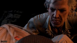 Baldur’s Gate 3: Blutleer heilen – diese Möglichkeiten habt ihr