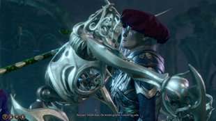 Baldur’s Gate 3: Zerstörter Turm und Keller im Unterreich finden