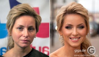 Atemberaubende vor- und nachher Fotos
