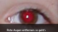 Rote Augen entfernen: So geht's mit kostenloser Freeware