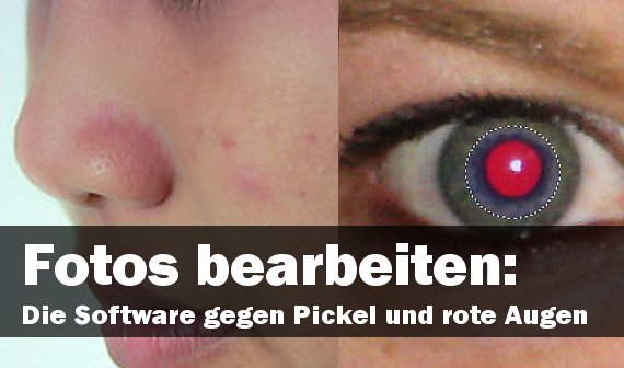 Fotos bearbeiten: Die richtige Software gegen Pickel und rote Augen