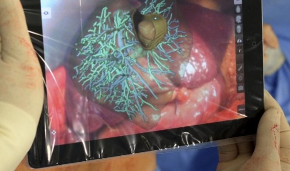 OP-Helfer iPad: Einsatz in der Chirurgie