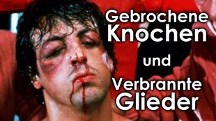 Verbrannt, Gebrochen, Geschnitten: 6 krasse Verletzungen am Filmset