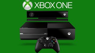 Xbox One Nat öffnen Xbox One Nat öffnen