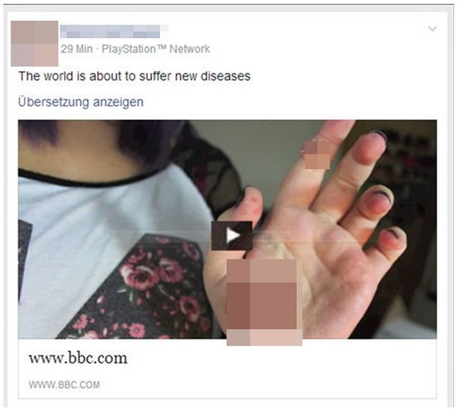 Facebook hack mit krankheitsbild