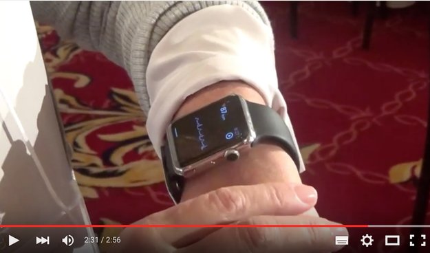 Ärzte zeigen EKG-Messung mit der Apple Watch
