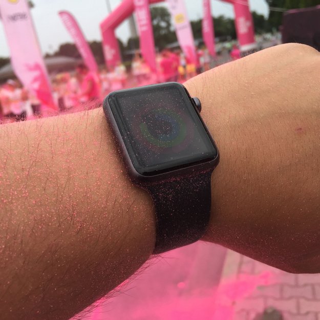 Mann will Verbrennungen durch Apple-Watch-Fehlfunktion erlitten haben