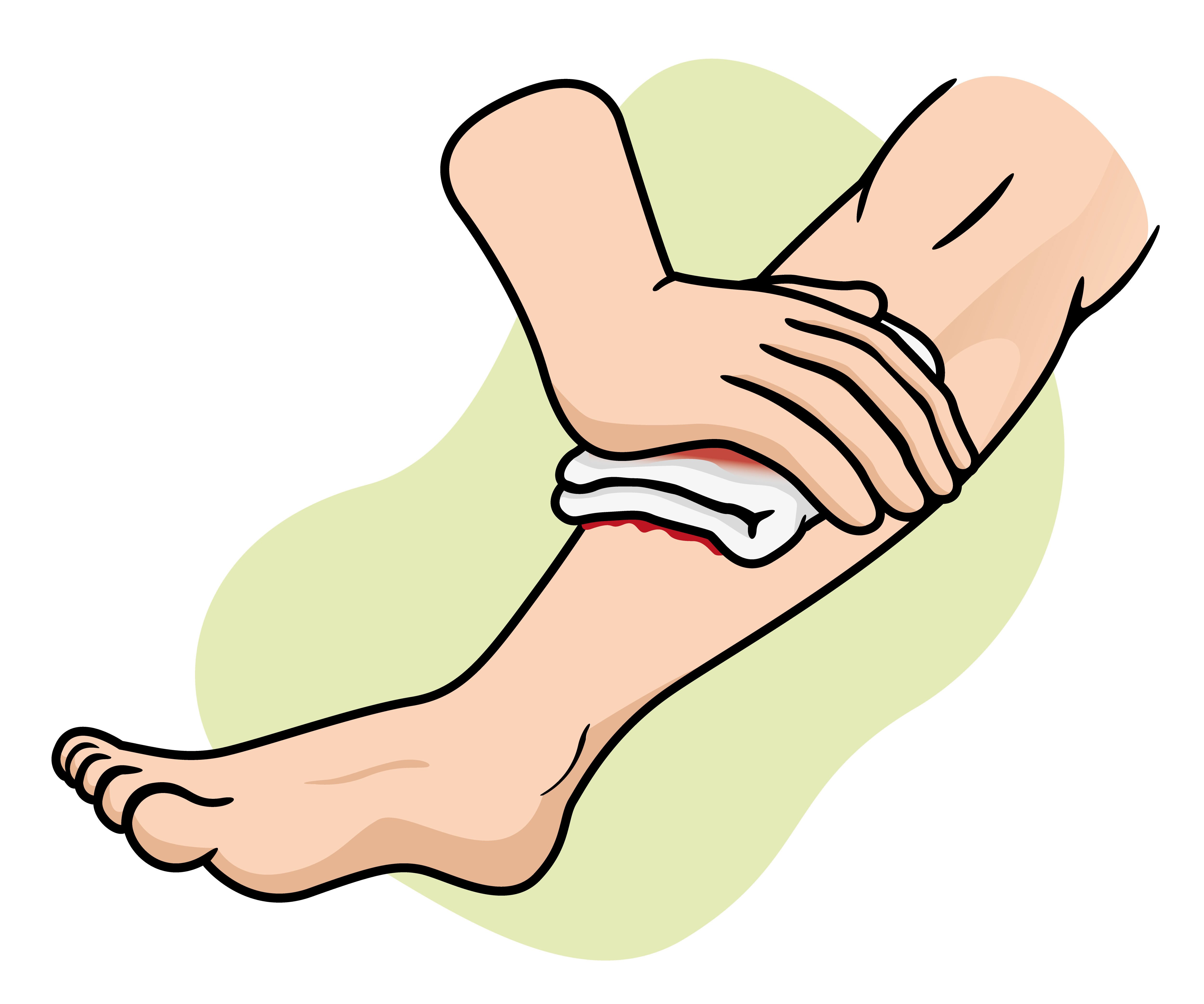 脚上的小伤口为什么会导致严重的糖尿病足 - 知乎