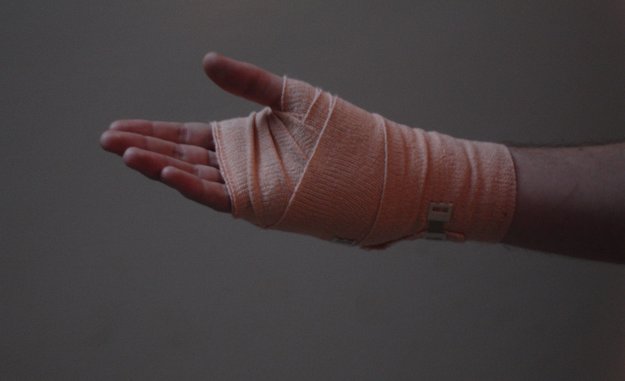„Smart Bandage“: Wundverband aus dem 3D-Drucker mit Sensoren und 5G geht bald in die Testphase