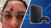 Frau bekommt Golfball gegen Kopf und bekommt PS4 als Entschädigung