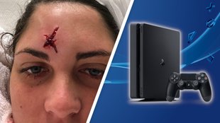 Frau bekommt Golfball gegen Kopf und bekommt PS4 als Entschädigung