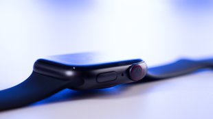 Apple Watch: Aufgepasst vor neuem Fallstrick bei der Smartwatch-Reparatur