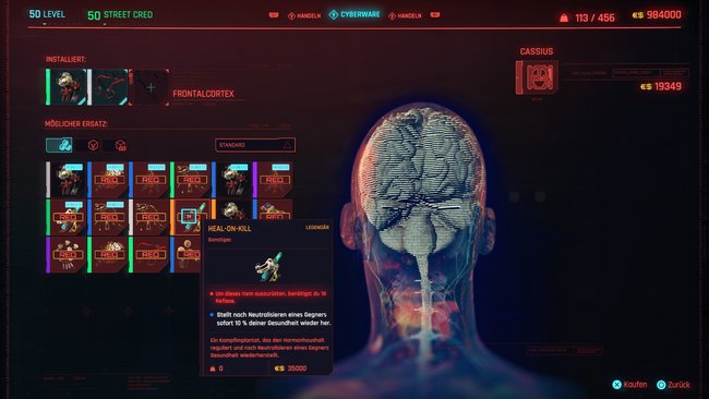 Legendäre Cyberware "Heal-On-Kill" in Cyberpunk 2077.