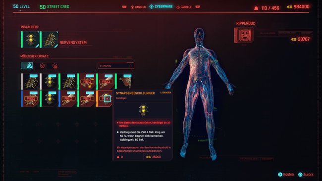 Legendäre Cyberware "Synapsenbeschleuniger" in Cyberpunk 2077.