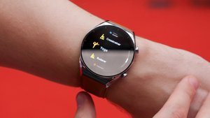 Xiaomi geht aufs Ganze: Nächste Smartwatch erhält komplett neue Funktionen