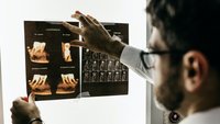 TÜV deckt auf: Nicht alle Röntgengeräte in Deutschland sind sicher
