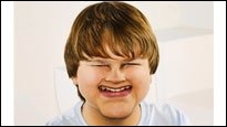 Stars mal anders - Photoshop-Lektion Nr. 1: Verunstalte das Gesicht einer Person